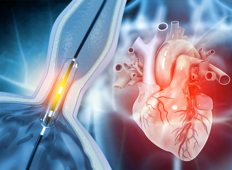 1726576058Interventional-Cardiology