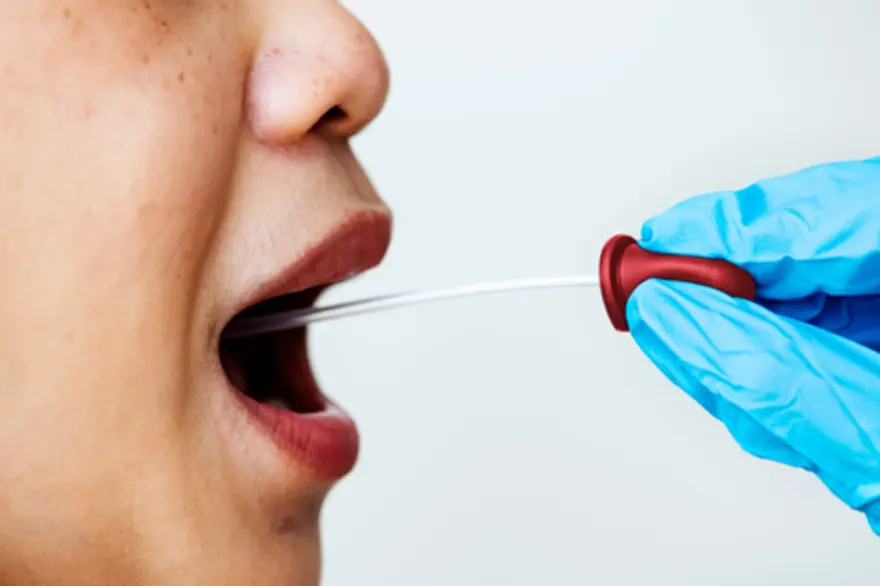 sputum-culture-test1751985555